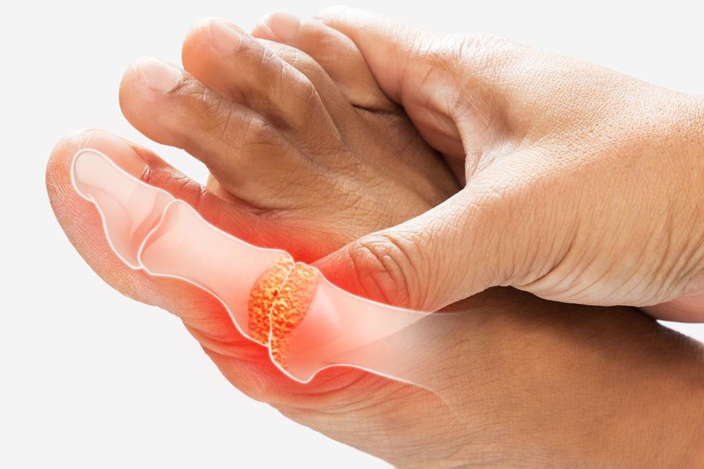 Detailed Gout Anatomy